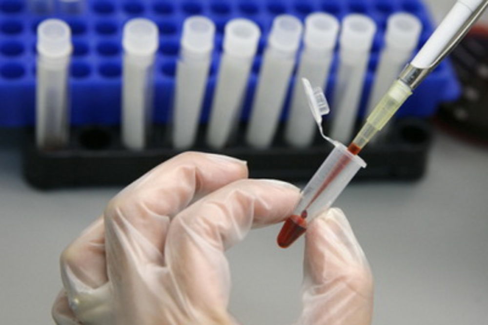 Karavan HIV testiranja u 30 gradova
