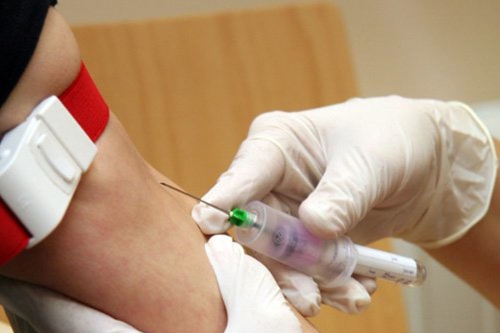 Nestašice testova najveći problem HIV pozitivnih