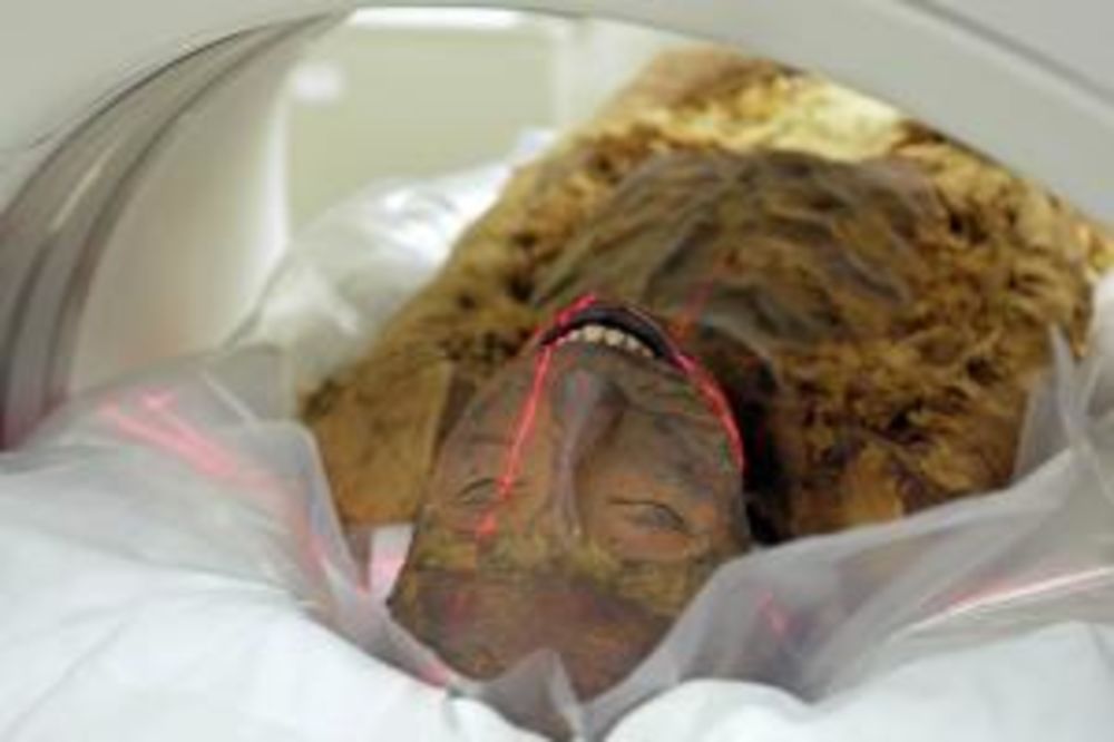 SISTEMATSKI: Mumija stara 3.000 godina poslata na skener
