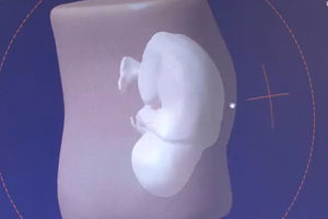 Za uspomenu: Fetus u 3D modelu