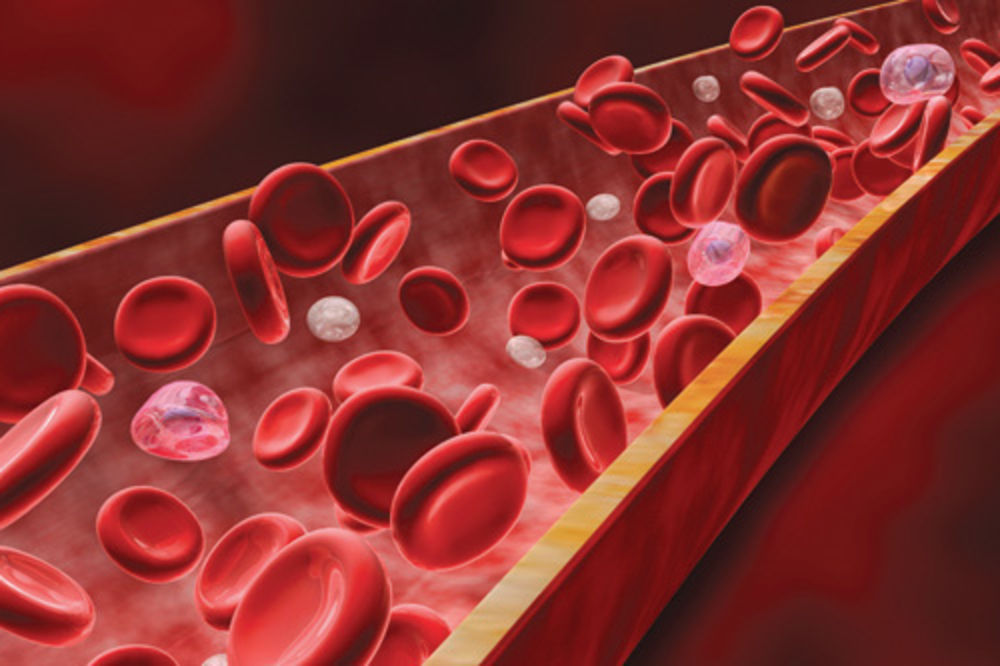 Manjak gvožđa u telu je korak do anemije