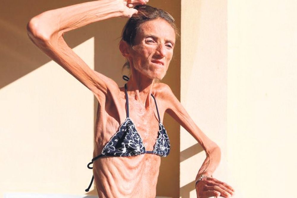 Ovo je najmršavija žena na svetu