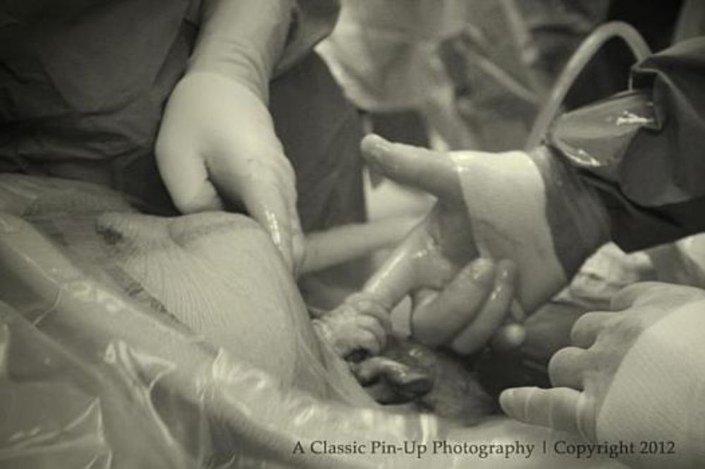 DIRLJIVO: Beba iz stomaka uhvatila doktora za prst