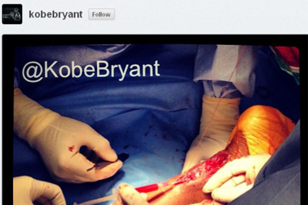 JEZIVO: Pogledajte nogu Kobija Brajanta tokom operacije