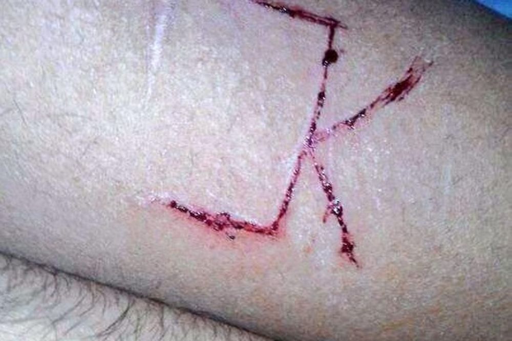 MORBIDNO: Nožem urezivali krvave inicijale JK na telu