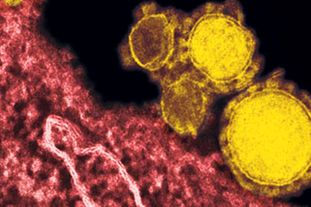 UBICA: Novi smrtonosni virus preti s Bliskog istoka