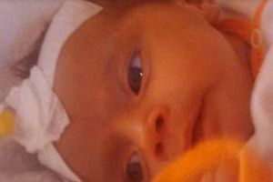 POMOZIMO: Bebi Belmini potrebno 5.000 evra za lečenje u Nemačkoj