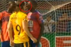 LJUDOŽDER KAO SUAREZ: Fudbaler ugrizao protivnika za nos