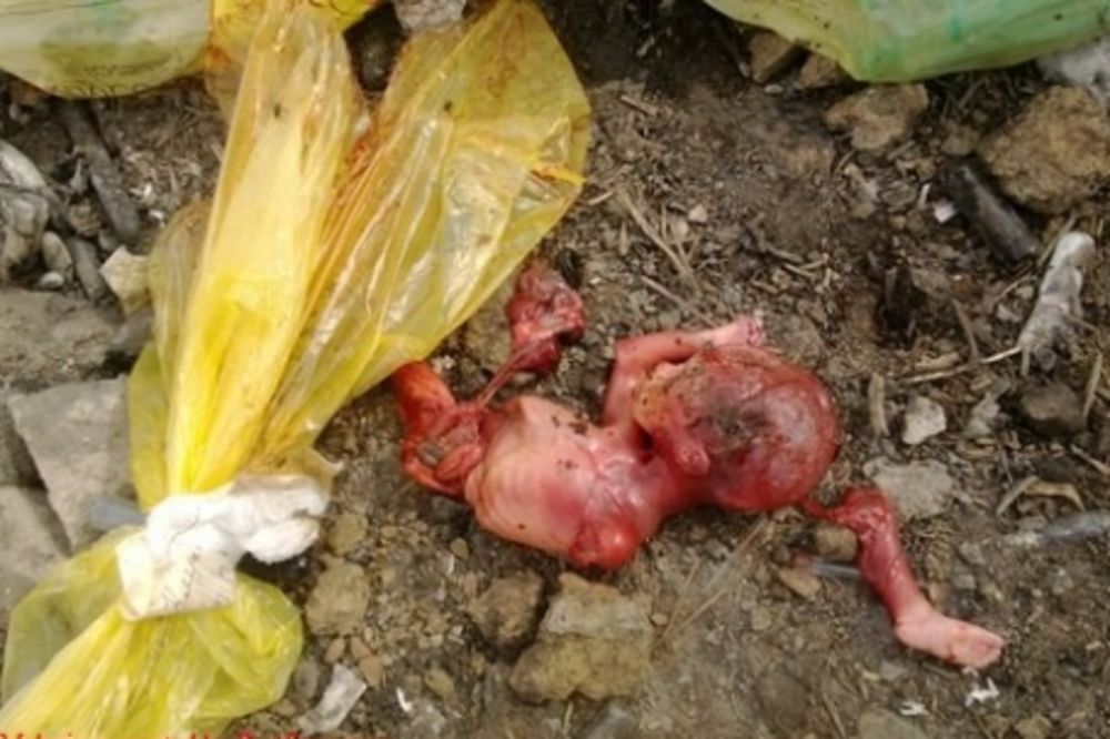 DEPONIJA UŽASA: Abortirani ljudski fetusi bačeni psima lutalicama
