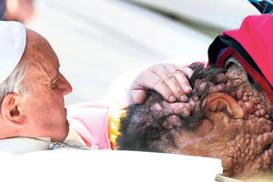 DIRLJIVO: Papa ljubio čoveka s čirevima po glavi