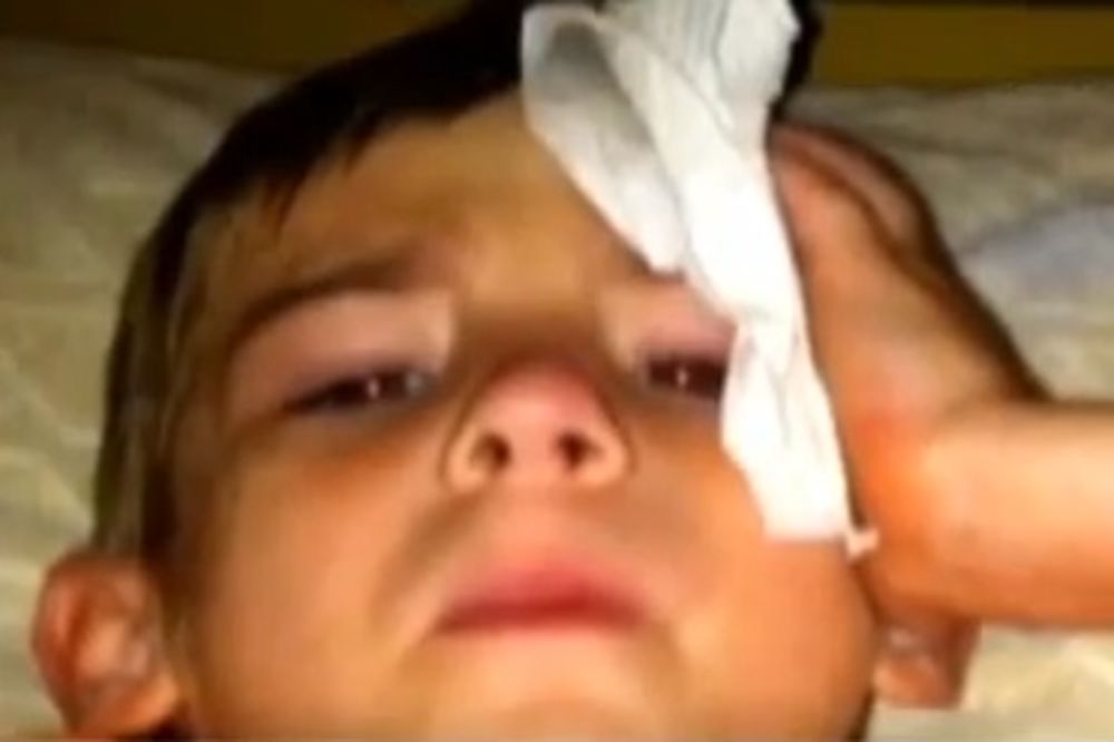 VIDEO SVE ZVEZDE: Deo meteorita dečaka (7) pogodio u glavu!