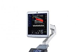 NAPREDAK: Najsavremeniji ultrazvučni aparat dostupan i pacijentima iz Srbije!