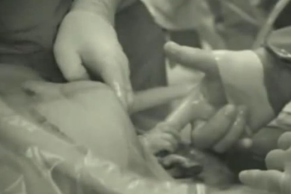 NESTRPLJIVA: Bebica zgrabila doktorov prst tokom carskog reza