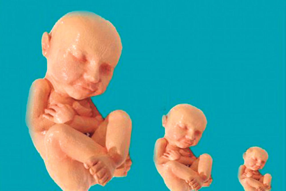 BIZARNO: Odštampajte fetus pomoću 3D printera