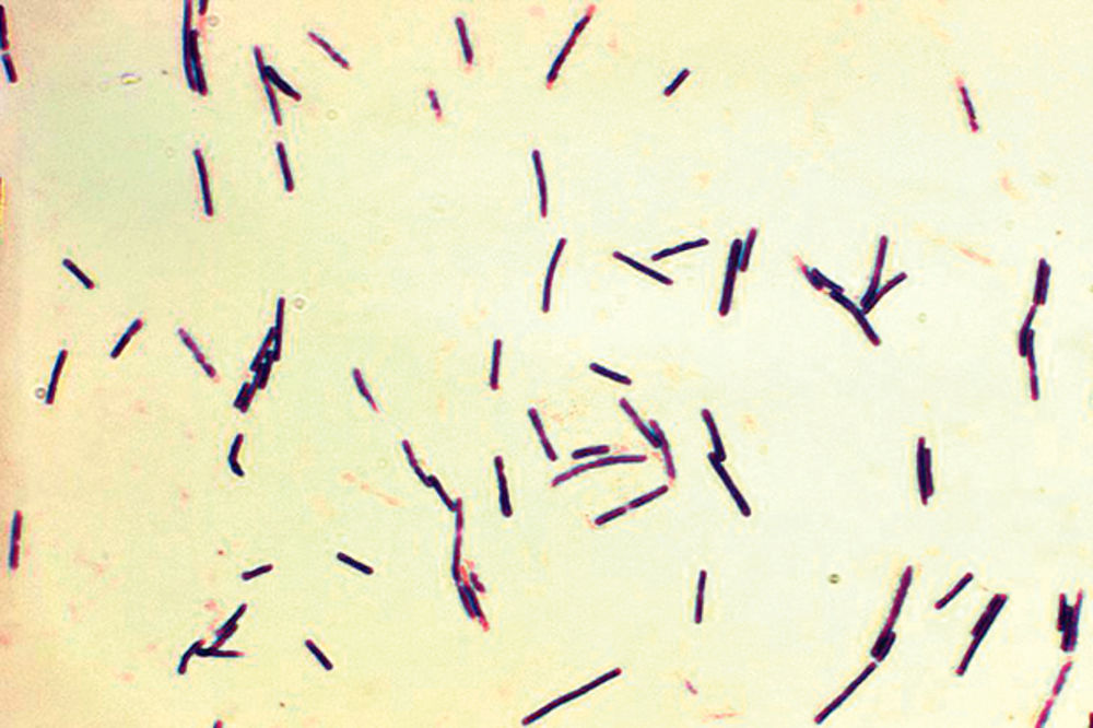 Opasna bakterija kriva za pojavu multiple skleroze?