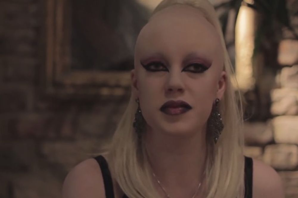GAĐALI JE KAMENJEM U ŠKOLI: Albino devojka postala uspešan model