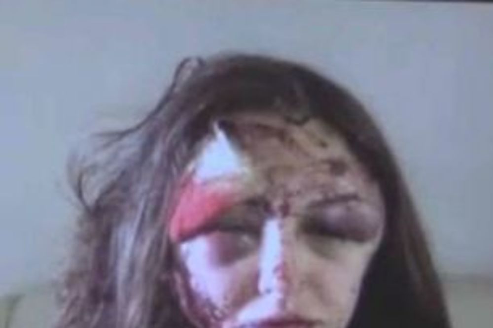 U BEKSTVU: Ruski milioner brutalno pretukao devojku posle raskida!