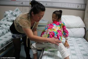 TUŽNA PRIČA MALE KINESKINJE: Devojčica (12) sa najvećim tumorom na svetu