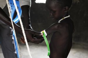 (FOTO) NAJTUŽNIJI PLAČ: Oni su među milion dece koja gladuje u Južnom Sudanu!