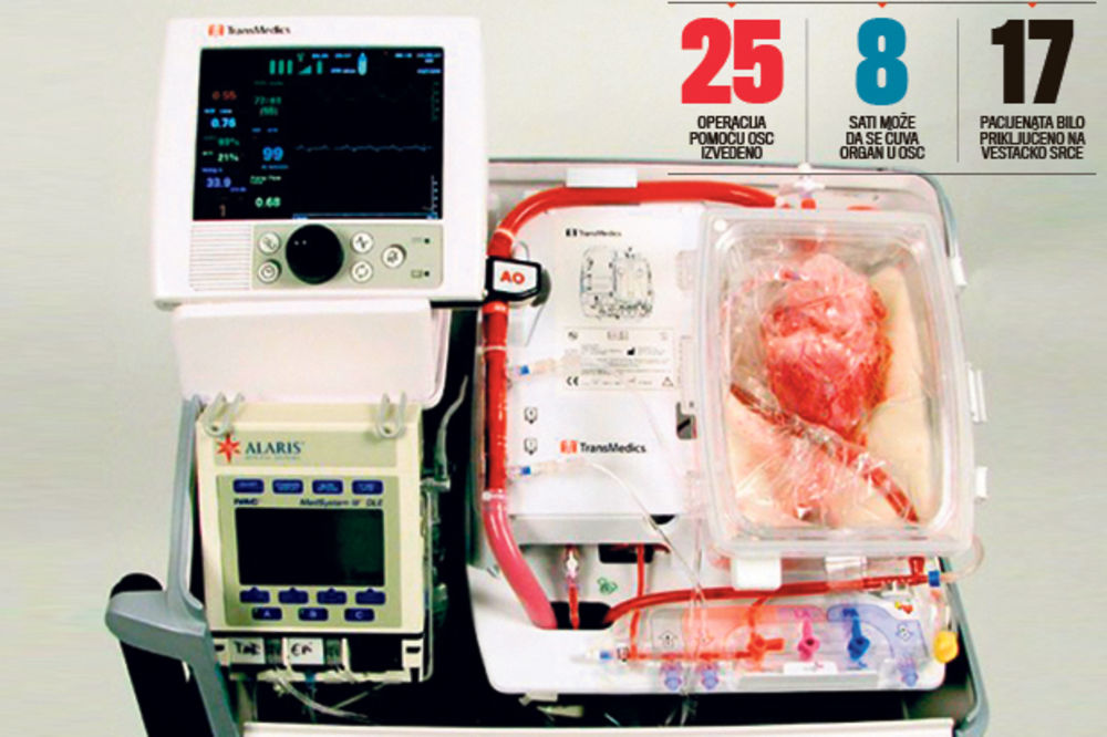 SRCE U KUTIJI: Aparat van tela održava organe za transplantaciju