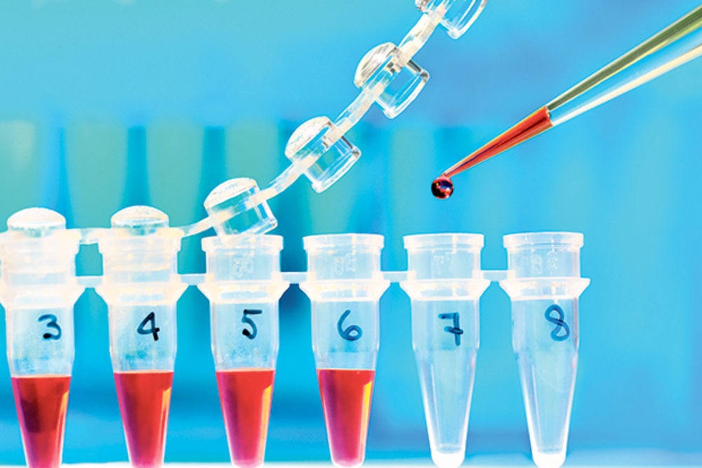 NEDOSTAJU PCR TESTOVI: Pacijenti s hepatitisom ostaće bez terapije!