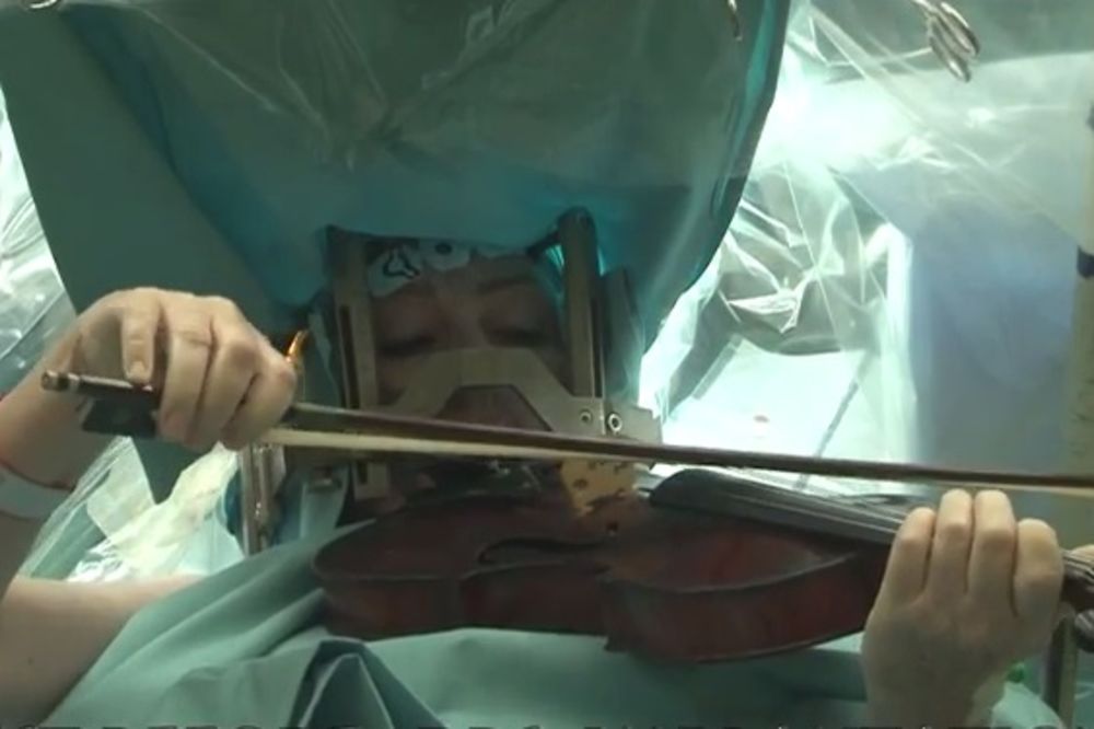 ČUDO NA OPERACIJI: Svirala violinu dok su joj operisali mozak! (VIDEO)