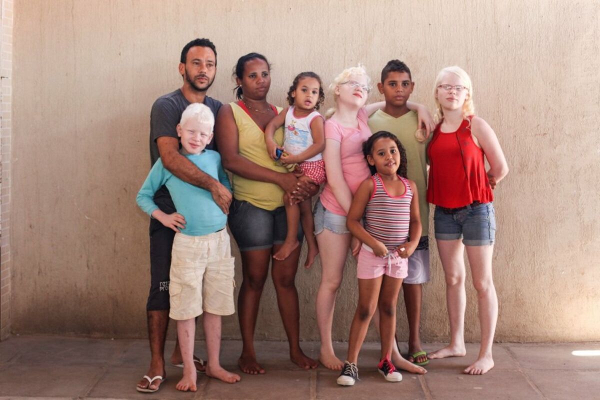 Первая семья в мире. Семья Пуллан. Необычные дети. Необычная семья. Семья альбиносов.