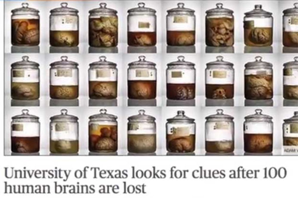 (VIDEO) KOME TO TREBA: Nestalo 100 mozgova iz zbirke Univerziteta Teksas