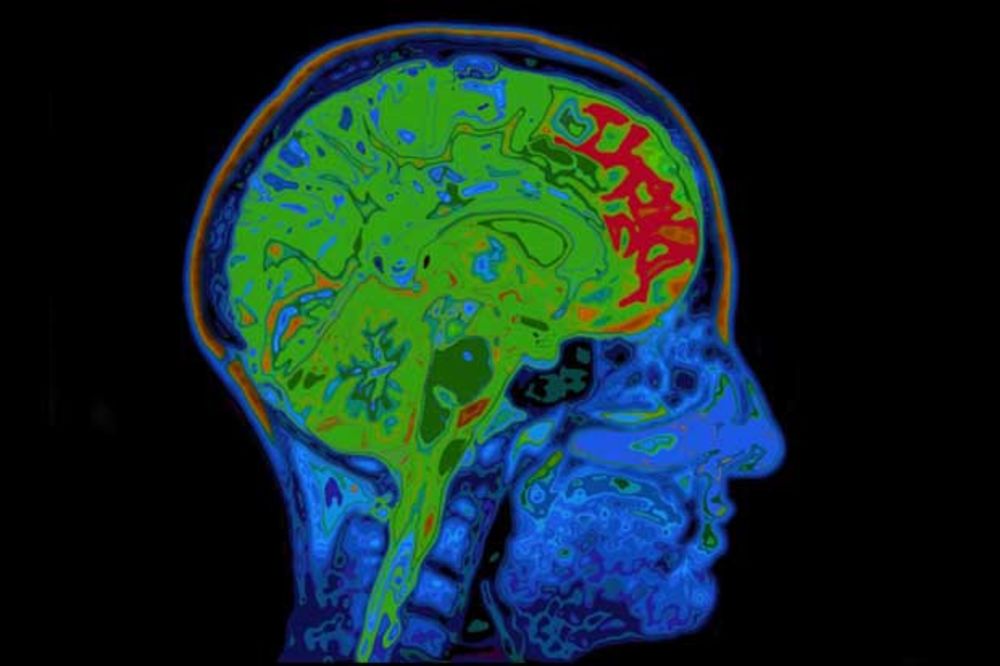TEST: Proverite zdravstveno stanje svog mozga za 20 sekundi