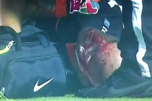 UZNEMIRUJUĆI VIDEO: Fudbaleru pukla glava tokom utakmice