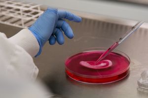 MOSKVA USAVRŠAVA NOVO LEČENJE: Matične ćelije ciljano ubijaju kancer