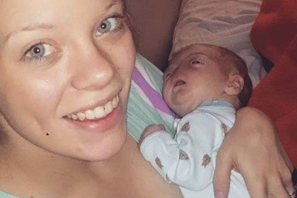 ŠOKANTAN ZAHTEV FEJSBUKA: Sklonite sliku sina rođenog bez nosa, kontroverzna je