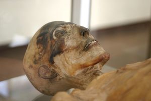 Mađarske mumije otkrivaju kako je tuberkuloza pokorila Evropu?