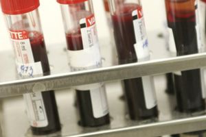 VELIKA GREŠKA U NIŠU: Pacijentu dali pogrešnu krv, bori se za život