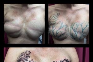 OŽILJCI, ALI SAMO NA SRCU: Tetovažom prekrila rezove od operacije grudi