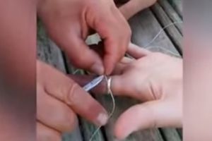 (VIDEO) Evo kako da skinete prsten sa natečenog prsta