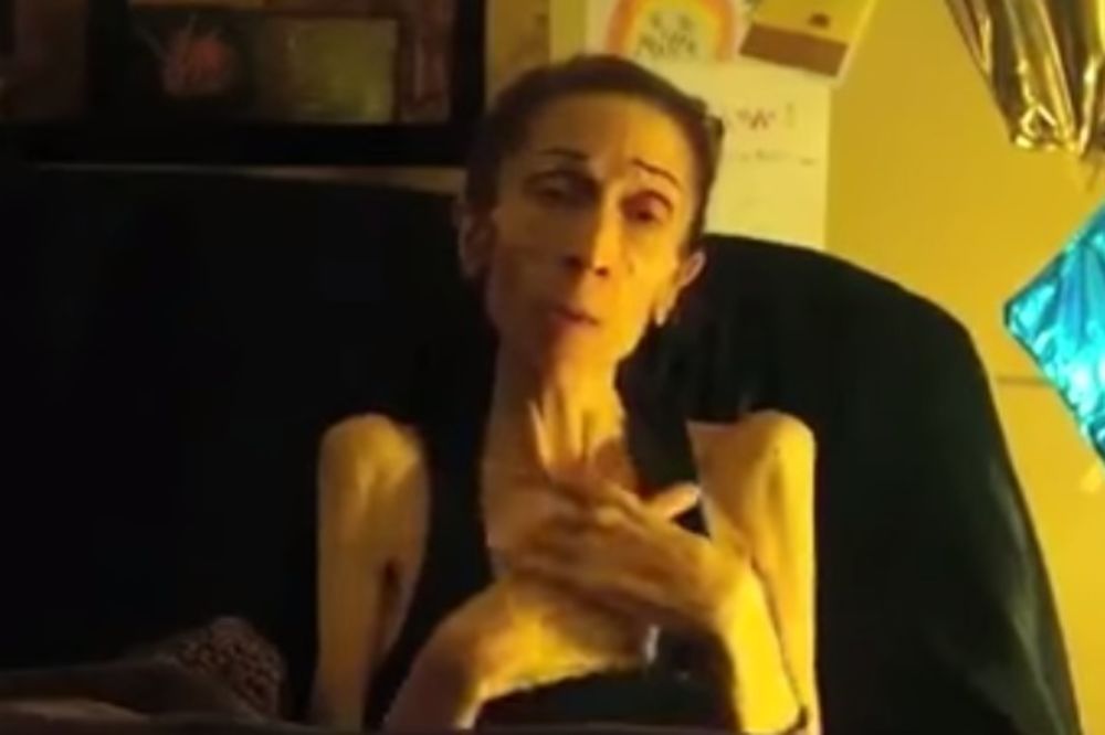 DOBRE VESTI: Anoreksična glumica uspela da skupi novac za lečenje!