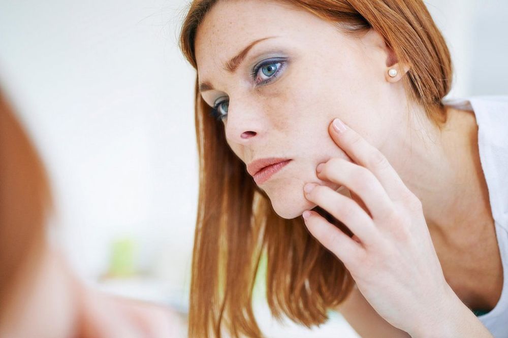 UKLONITE BORE OKO USANA: Ove terapije će vašem licu vratiti sjaj