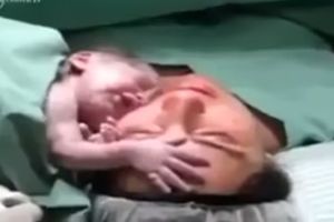 (VIDEO) NAJJAČA LJUBAV NA SVETU: Novorođenče ne može da se odvoji od majke