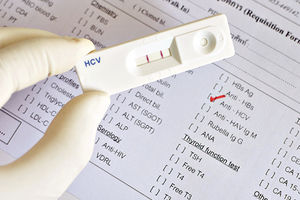 SELEKCIJA PACIJENATA: Teško do testiranja osoba na hepatitis