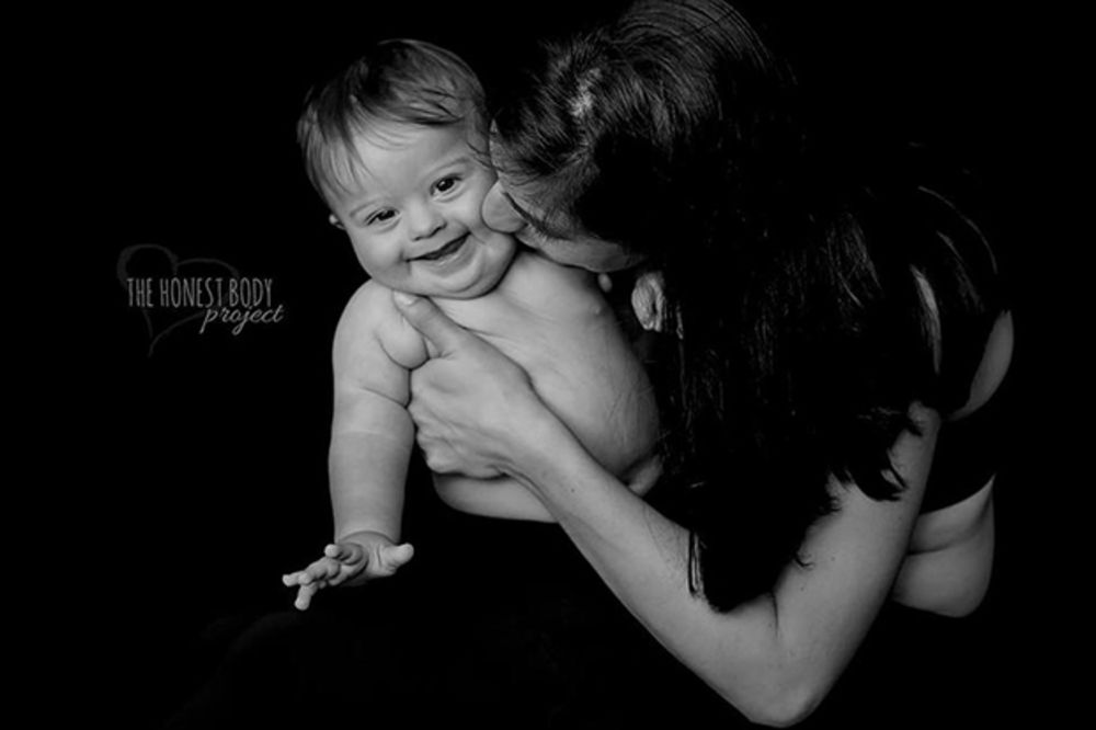 (FOTO) Fotografije obojene ljubavlju i bolom: Ponosne majke poziraju sa decom sa posebnim potrebama
