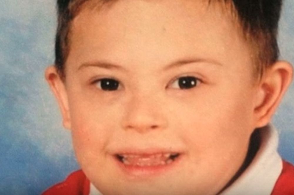 SKANDAL U BRITANIJI: Dečak sa Daunovim sindromom umro jer nije stigao na red kod lekara