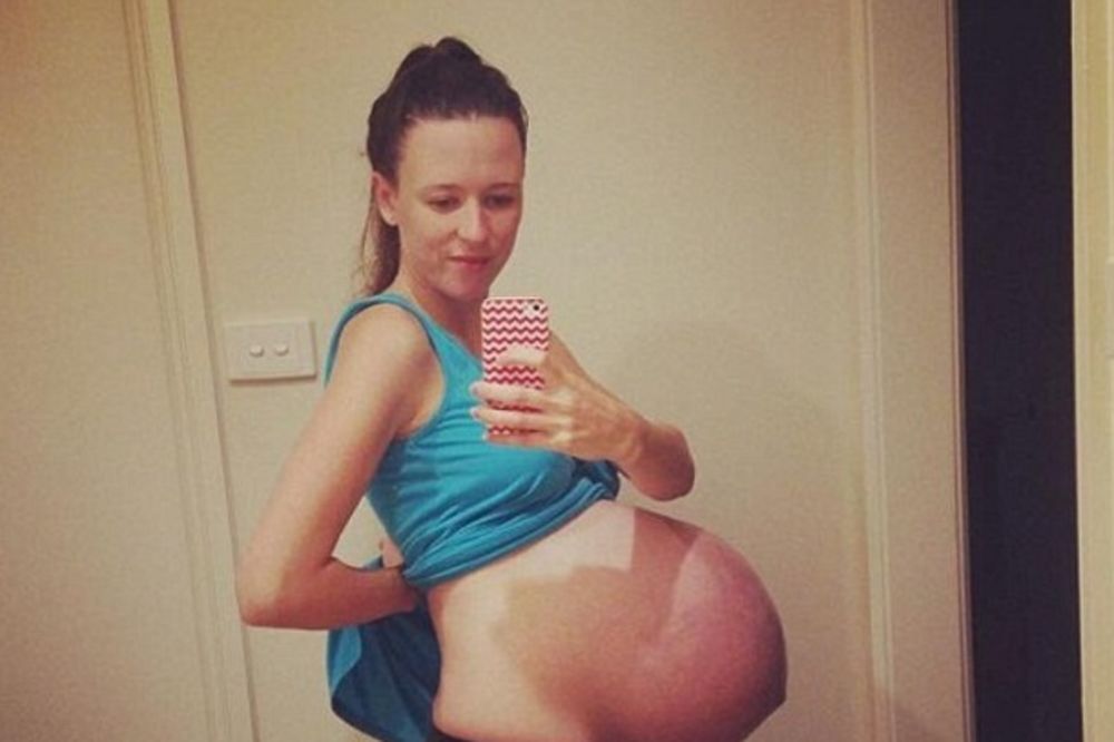 (FOTO) Postavila ogroman trudnički stomak na Fejs, pa prošla kroz pravi pakao!