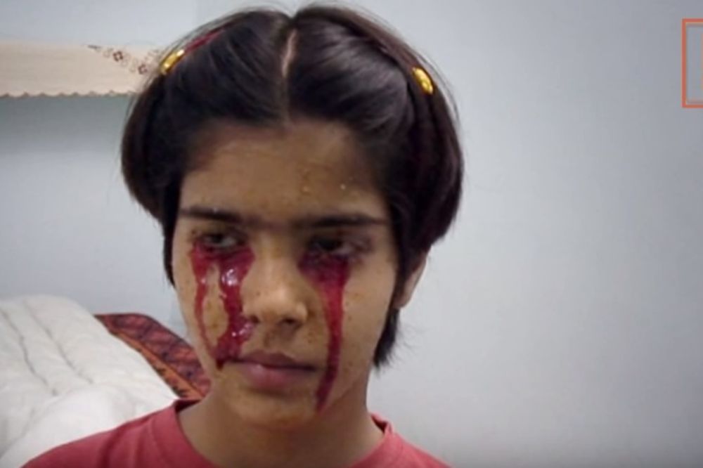 (VIDEO) DOKTORI ŠOKIRANI I ZBUNJENI: Devojčica koja plače krv umesto suza!