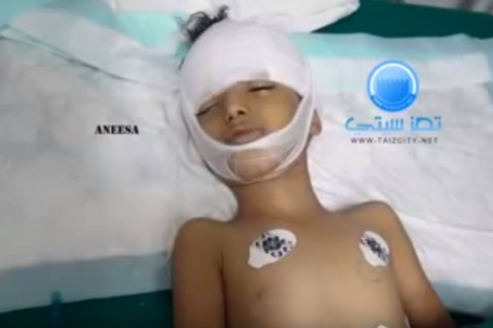 (UZNEMIRUJUĆI VIDEO) NEMOJTE DA ME SAHRANITE: Dečak iz Jemena molio doktore da ga spasu...