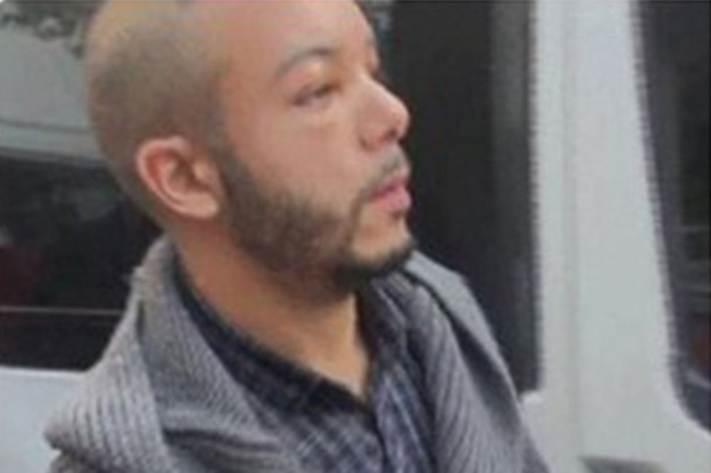 SVE ZA LEPOTU: Džihadista uhapšen tokom transplantacije kose