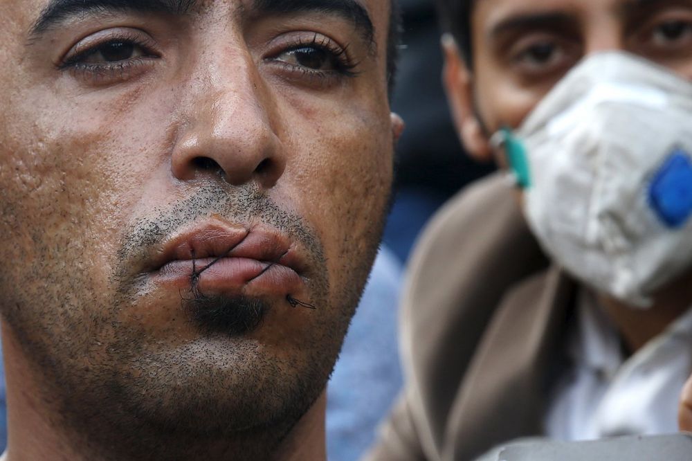 (UZNEMIRUJUĆI FOTO) HOROR NA GRANICI GRČKE I MAKEDONIJE: Migranti u znak protesta zašili sebi usne