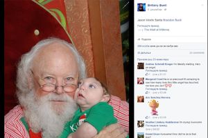 (VIDEO I FOTO) MALI HEROJ: Dečak rođen bez pola lobanje je prvi put upoznao Deda Mraza