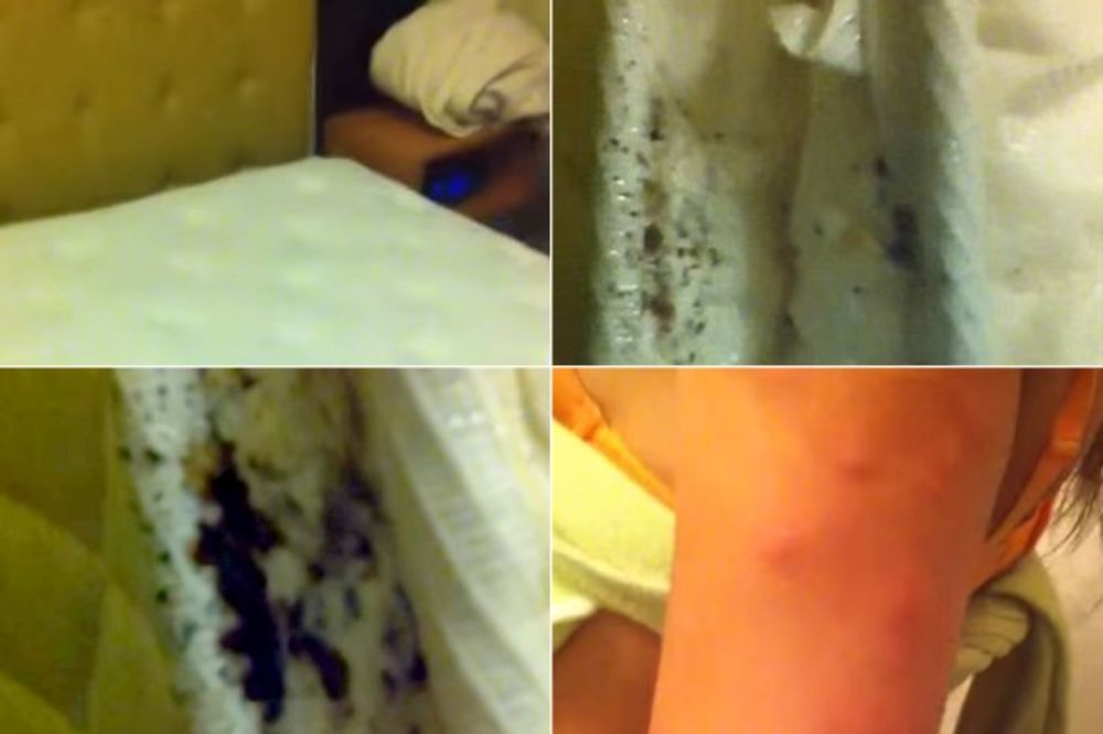 (VIDEO) PAKLENI HOTEL! Par otkrio da su spavali na dušeku sa preko 50 buba!