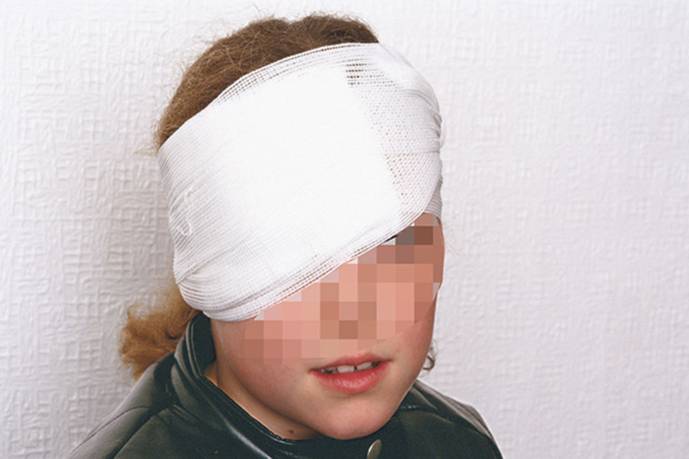 NESREĆA NA BADNJE VEČE: Eksplozija petarde teško povredila oko devojčici (11) u Veterniku